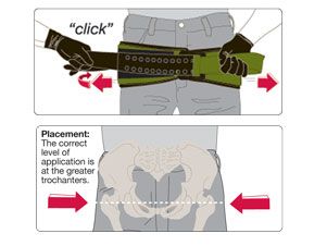 SAM Pelvic Sling